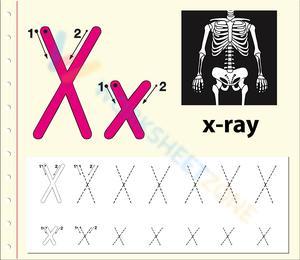 X is for X-ray