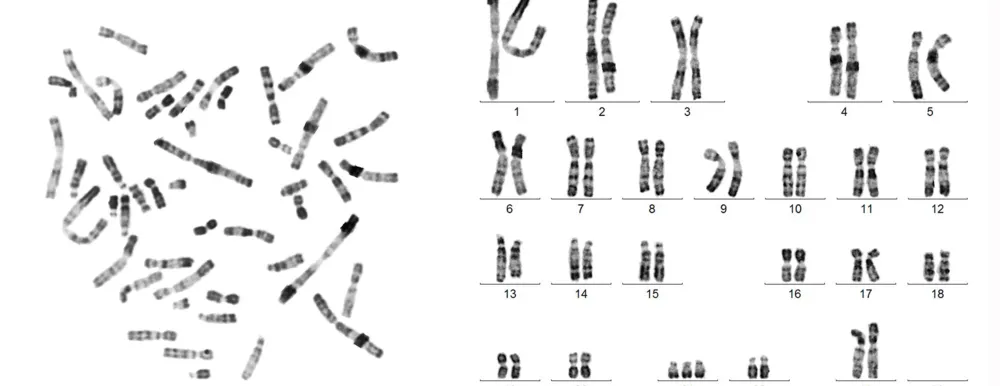 Karyotyping & Applications: Comprehensive Quiz