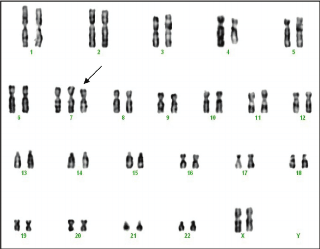 Karyotyping in Cancer: Applications & Analysis Quiz