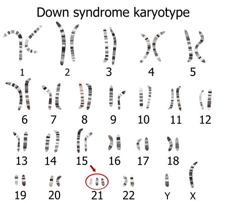 Karyotype Analysis and Chromosome Abnormalities