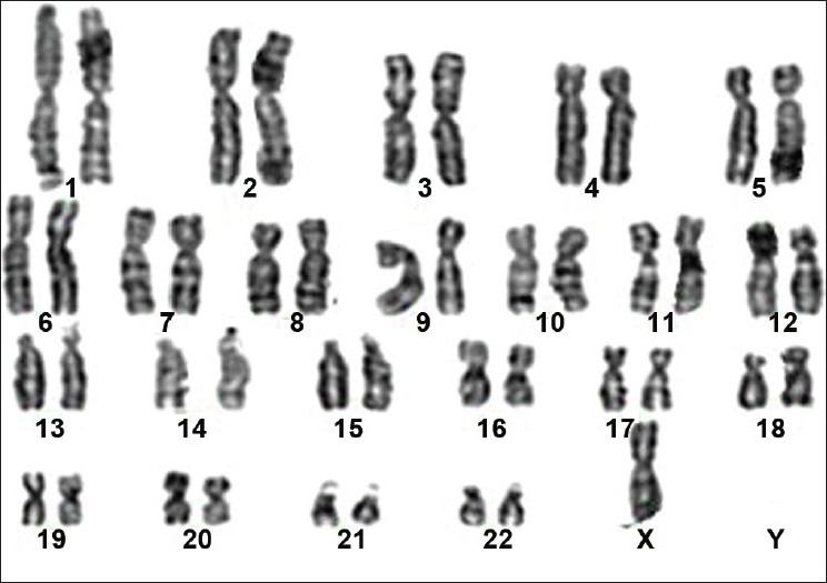 Karyotypes Check-in Quiz