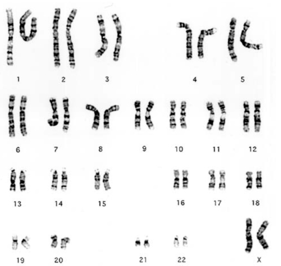 Karyotypes Quiz
