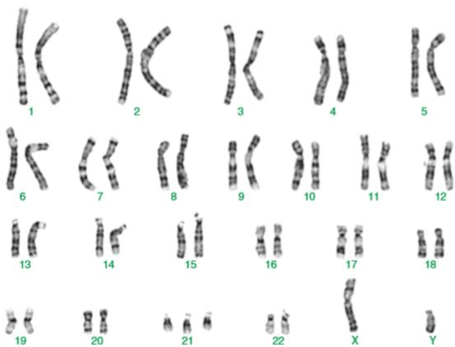 Free Karyotype Worksheet with Answer Keys for Students